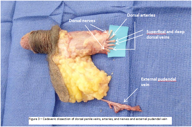 解剖学研究_阴茎静脉神经结构_2023